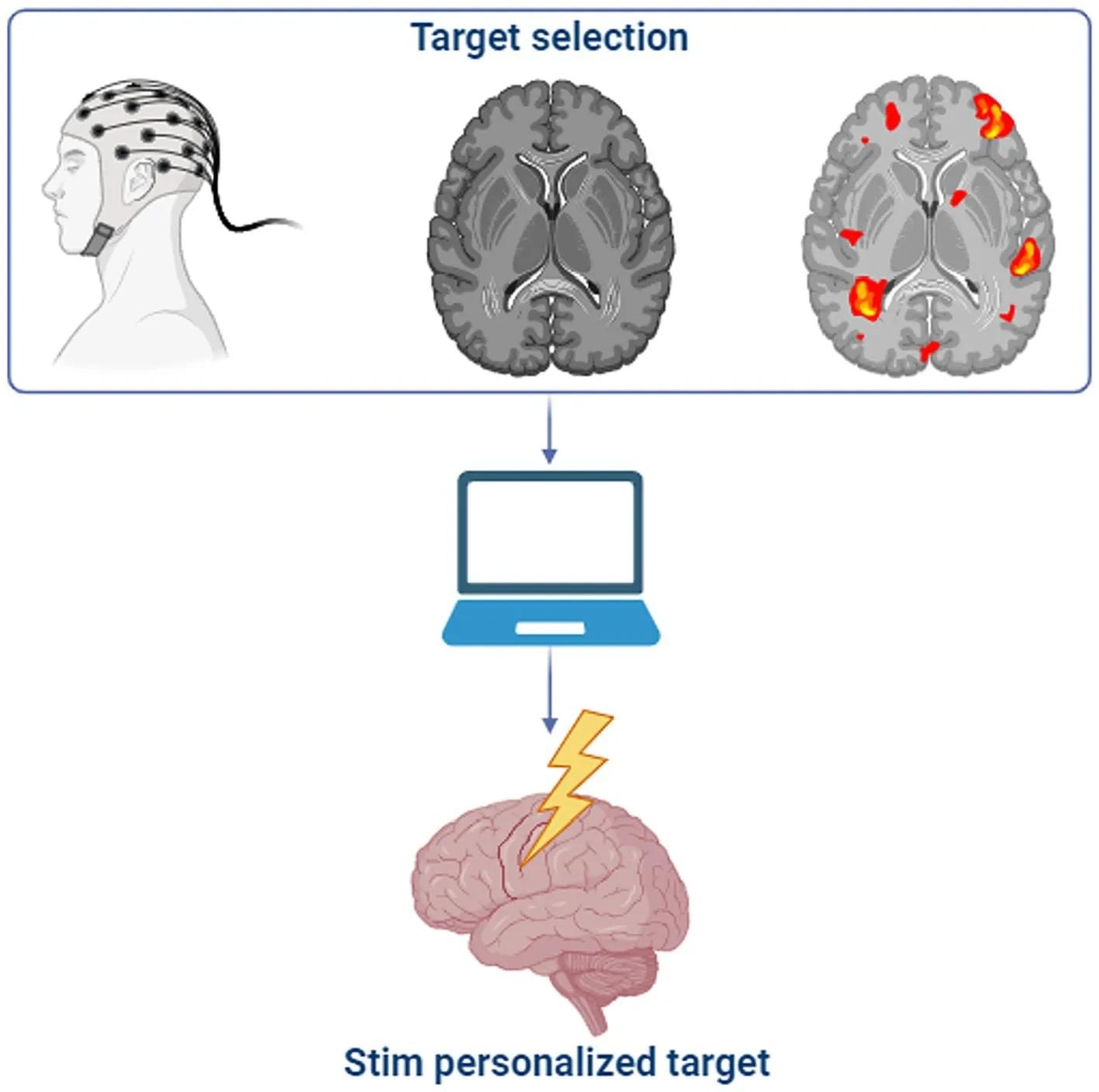 Transforming Neurostimulation with Brain-Computer Interfaces