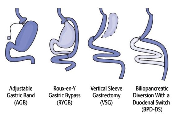 Bariatric Must Haves