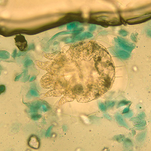 Adult females of Sarcoptes scabiei mites are 0.30-0.45 mm long by 0.25-0.35 mm wide; males are smaller at 0.20-0.24 mm long by 0.15-0.20 mm wide.  Adults live in the skin and are usually found in skin scrapings.