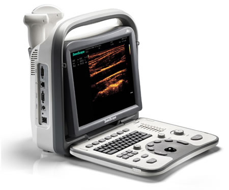 Bule skam chokerende Sonoscape A6 Portable Ultrasound Machine from SonoLogic : Get Quote, RFQ,  Price or Buy