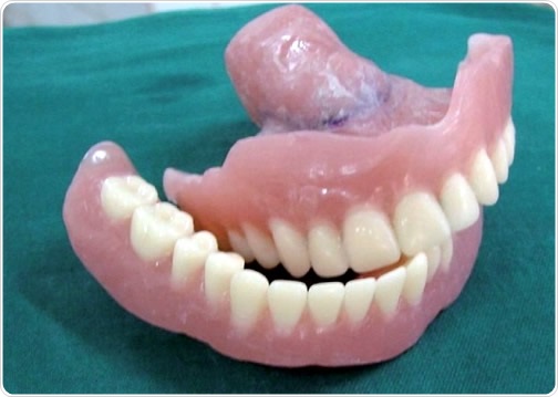 What are Dentures?
