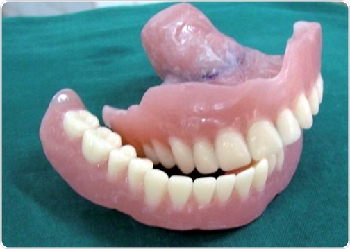 How Long Does It Take To Get Dentures After Impressions