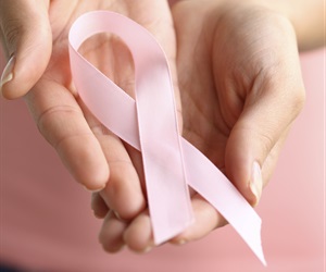 Stroke risk factors rise in post-menopausal women diagnosed with breast cancer