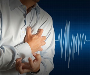 Researchers identify why heart attack triggers arrhythmia in some people