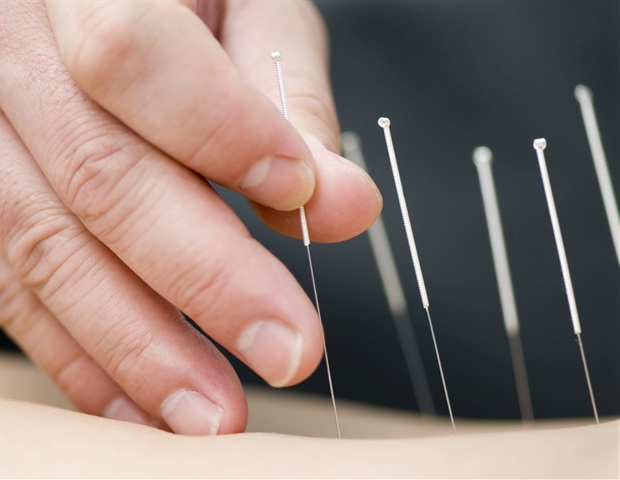 Cancer patients report less dry mouth after receiving acupuncture treatment