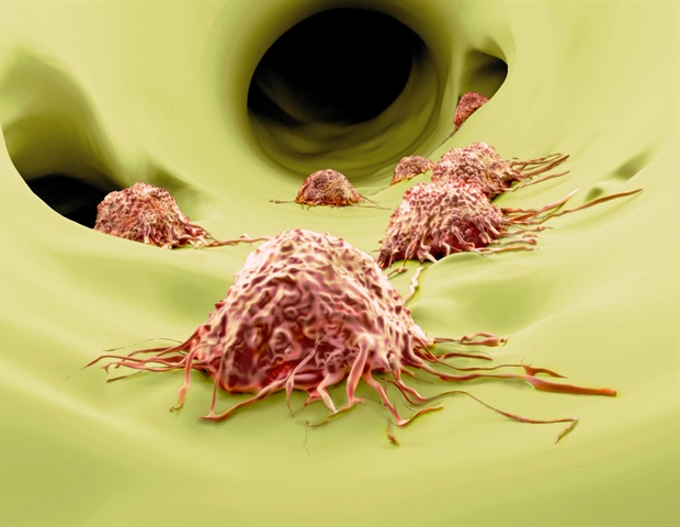 Two new grants to support researchers to better understand, manage metastasis of melanoma