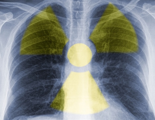 Study evaluates role of PET/CT in selecting candidates for peptide receptor radionuclide therapy