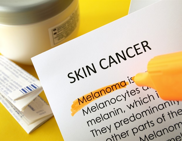 New way to help dermatologists determine patient's risk of developing melanoma