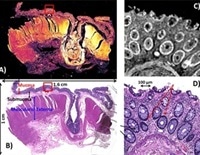 Using A Spero Microscope For Large Area Infrared Chemical Imaging