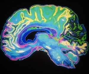 Experts address sleep disorders following traumatic brain injury