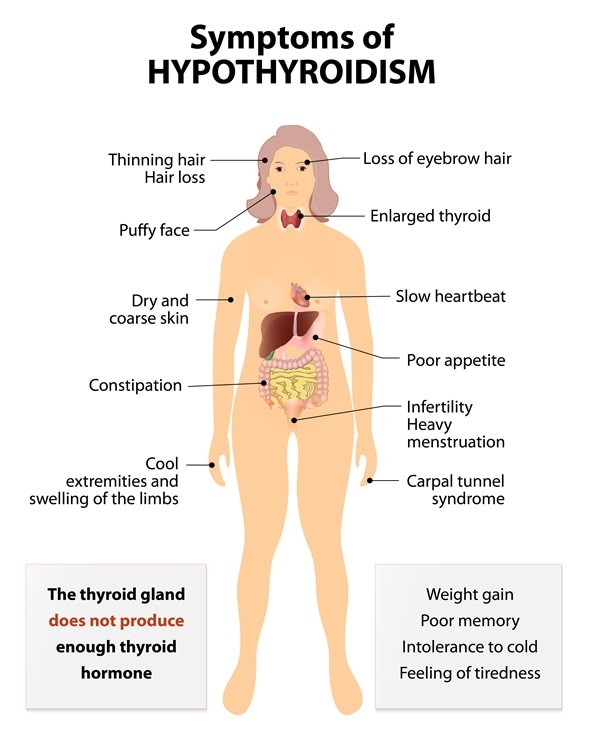 Symptoms hyperthyroidism 14 Thyroid