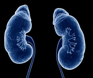 Chronic kidney disease rates are increasing faster than other noninfectious diseases