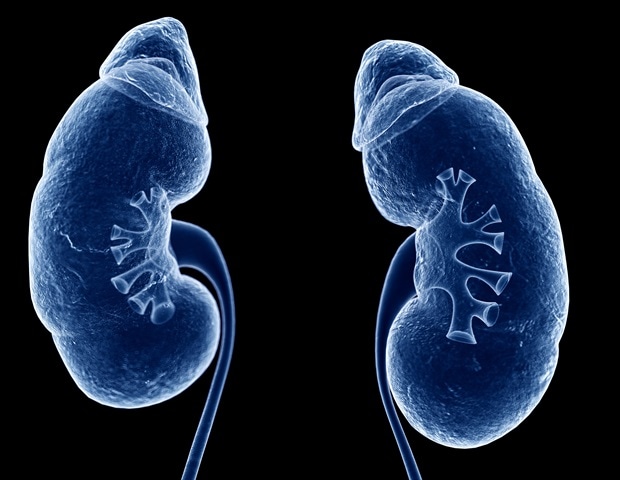 New mathematical model can predict risk of kidney injury after common heart procedure