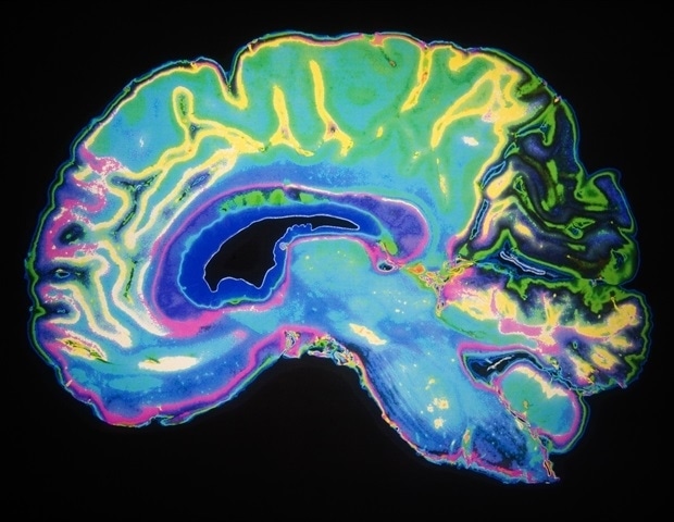 Brain scans may be promising tool to identify suicide risk in people with mood disorders