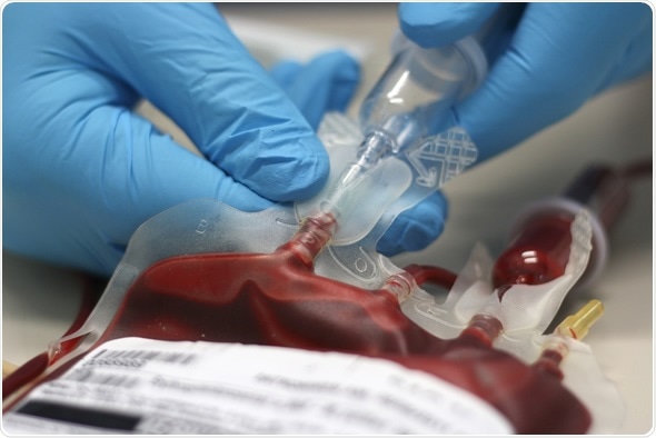 A bag of transfusion blood - Image Copyright: SebGross / Shutterstock A bag of transfusion blood - Image Copyright: SebGross / Shutterstock