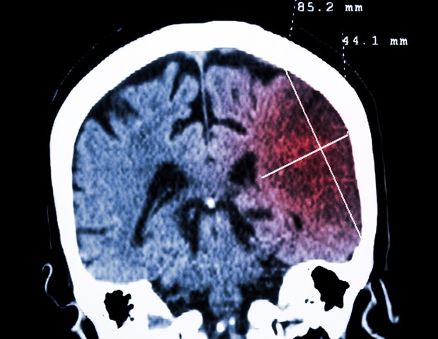 Experts call for public health campaign aimed at promoting 'brain-healthy lifestyle' Experts call for public health campaign aimed at promoting 'brain-healthy lifestyle'