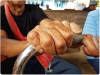 Diagnostico E Classificacao Da Lepra