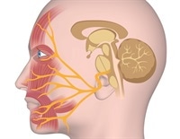 Bell S Palsy Diagnosis