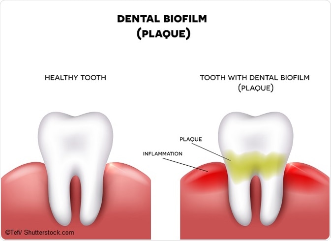 Guide To Brushing Your Teeth