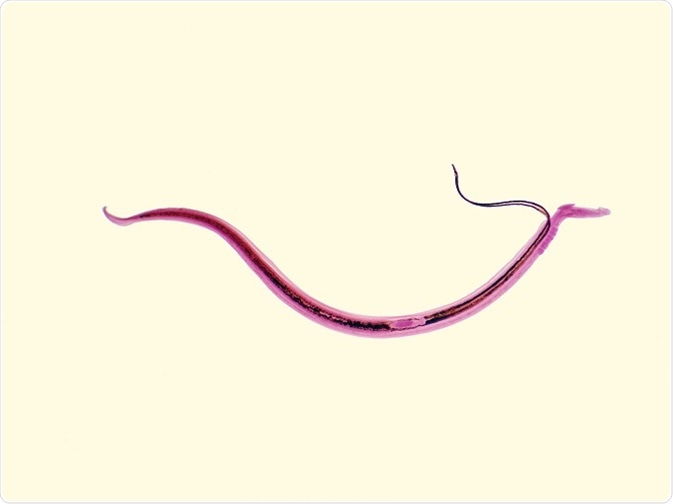a férgek szélesek pinworms gyermekek képei