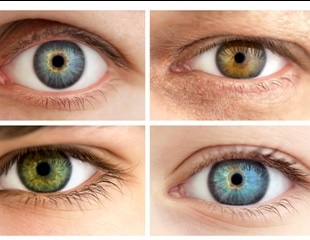 Genetics Of Eye Color