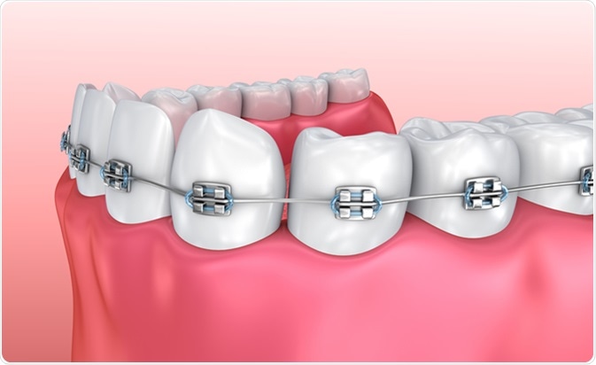 Advanced Dental Concepts