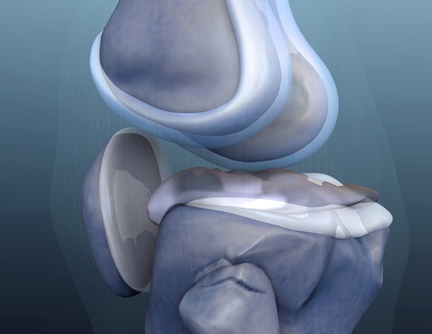 Study compares unicompartmental knee arthroplasty and total knee arthroplasty