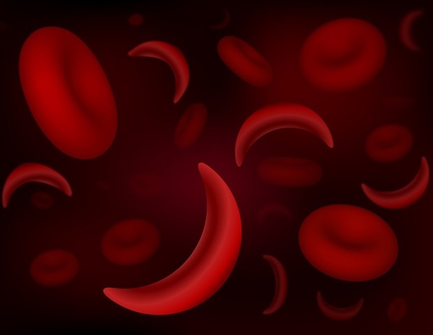 Researchers make breakthrough in gene therapy for sickle cell disease