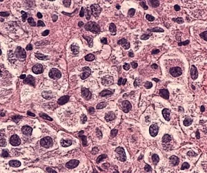 Researchers grow hairy skin using mouse stem cells