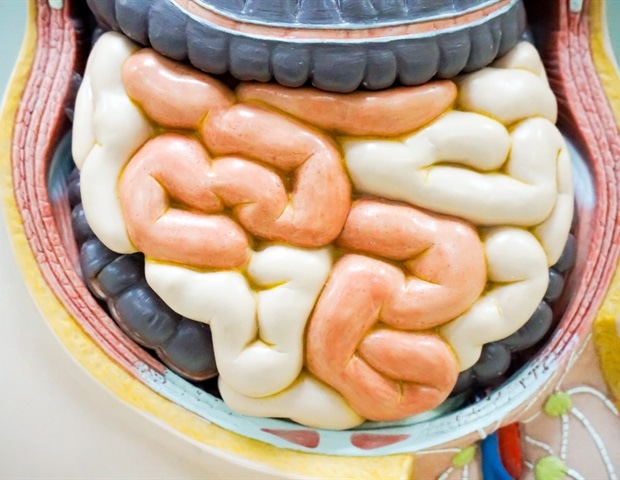 Mount Sinai researchers discover drug resistance signature in Crohn's disease Mount Sinai researchers discover drug resistance signature in Crohn's disease