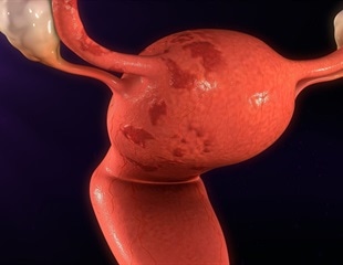 Prevention and treatment of endometrial hyperplasia