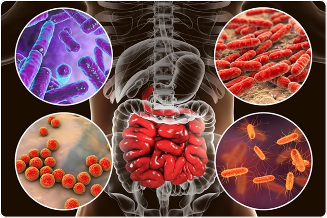 Dysbiosis bacteria