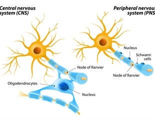 neuropathy diagnosis