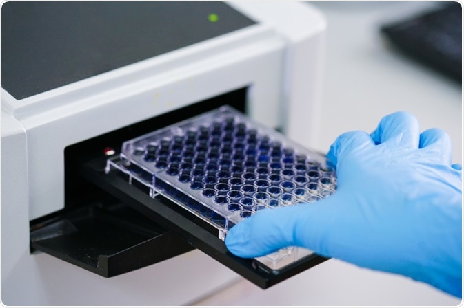 Enzyme Linked Immunosorbent Assay Elisa Methodology