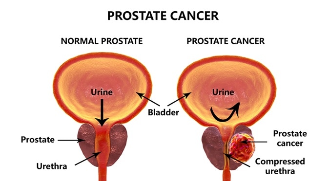 prostate anatomie 3d