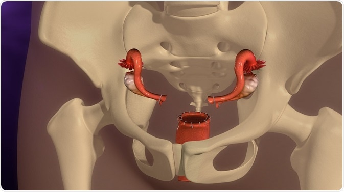 Chronic Health Issues With Hysterectomy