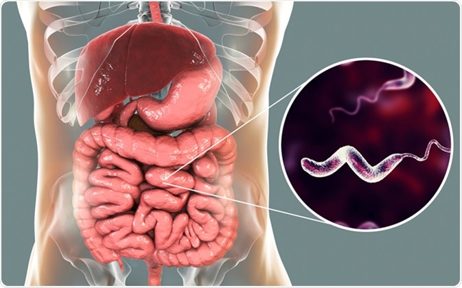 Sintomas de Campylobacteriosis