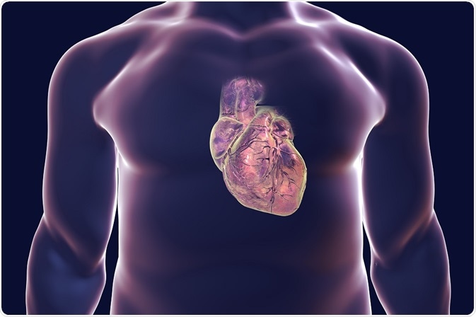 Que é doença cardíaca Valvular?