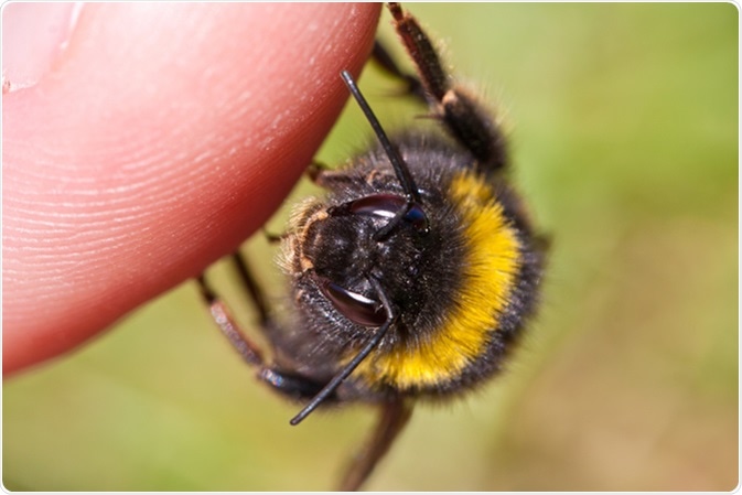 How to Treat a Bee Sting