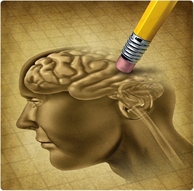 Understanding Alzheimer's and Brain Health - Article - Community Care  Physicians P.C.