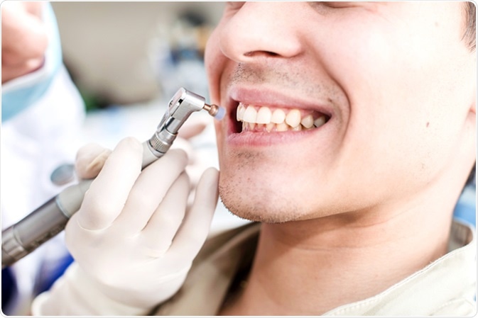 Tooth Polishing Procedure