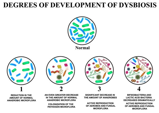 Dysbiosis o que e Dysbiosis who definition - rezolvaripbinfo.ro