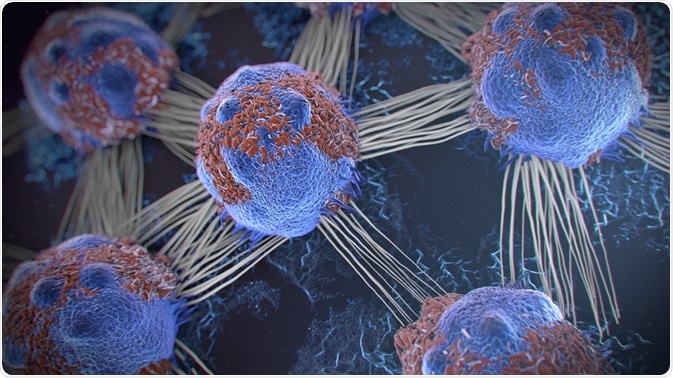 celulas cancerigenas de la prostata