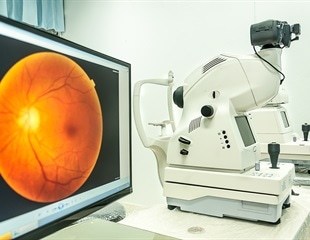 Alzheimer’s screening may one day be carried out using an eye exam