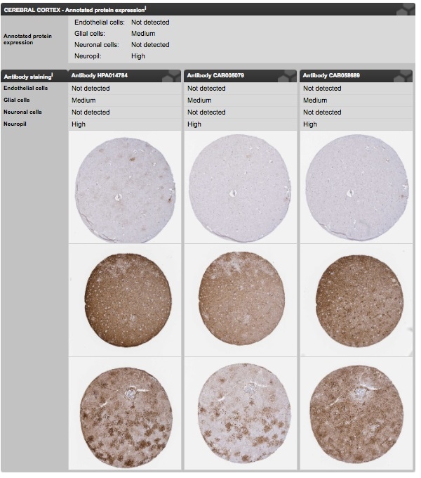 Aquaporin 4 cerebral cortex page on the Tissue Atlas. Image from the Human Protein Atlas portal.