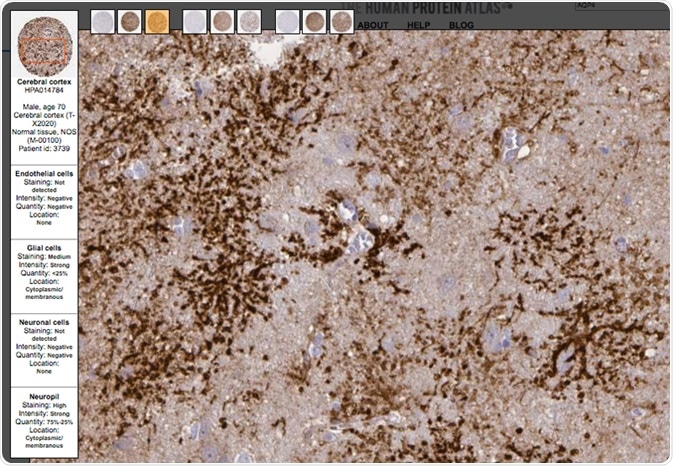 Closeup of an example staining on the Aquaporin 4 cerebral cortex page on the Tissue Atlas. Image from the Human Protein Atlas portal.