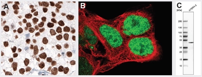 NANOG protein normally is expressed during early embryonal development and is absent in normal adult tissues. Overexpression is observed in testicular embryonal carcinoma, shown by IHC staining using monoclonal Anti-NANOG (AMAb91393). Anti-NANOG antibody AMAb91393 also shows nuclear positivity in NTERA-2 cells and band of expected size in the WB assay. NTERA-2 cells are pluripotent human embryonal carcinoma cell line, exhibiting biochemical and developmental properties similar to the cells of the early embryo.