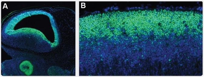 SOX2 is persistently expressed during embryonal development, first in the epiblast of preimplantation embryos, then more predominantly in the central nervous system after gastrulation. Immunohistochemical staining using monoclonal Anti-SOX2 (AMAb91307) shows nuclear positivity in the developing brain and eye (A) and neural tube (B) of mouse embryo.