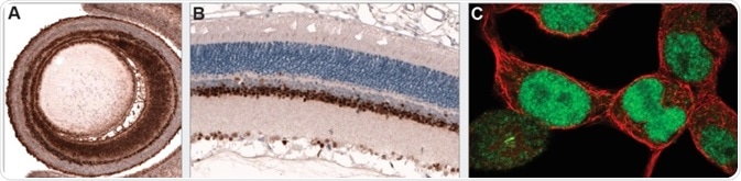 PAX6 is an essential transcription factor for overall eye development. Immunohistochemical staining using monoclonal Anti-PAX6 (AMAb91372) shows positivity in the developing eye of mouse embryo (A) and adult rat retina (B). ICC-IF staining in HEK-293 cells shows nuclear immunoreactivity.