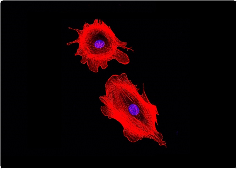 Fibroblast cells - By DrimaFilm